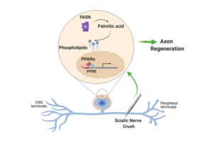 drawing of the sciatic nerve being injured with a zoom in on ppar alpha, phospholipids, fasn, and palmitic acid highlighted