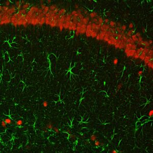 microscopy image of brain cells labeled green and red