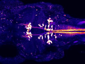 fluorescently labeled zebrafish nervous system