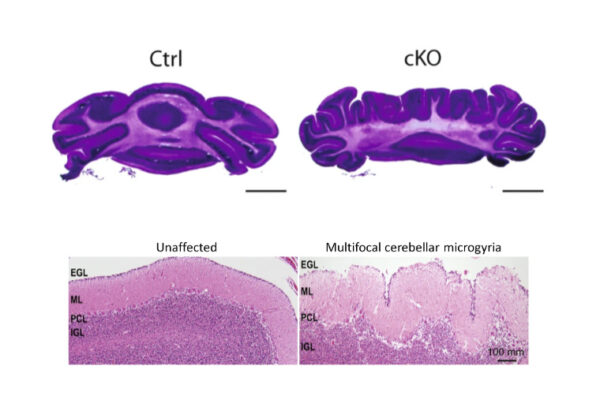 Collaborative team investigates protein that underlies CHARGE syndrome