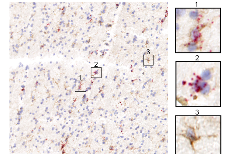 Transcriptomic changes in glia linked to specific neurodegenerative diseases