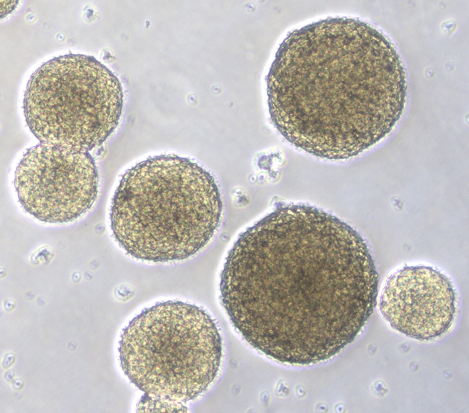 Microscopy image of cortical organoids
