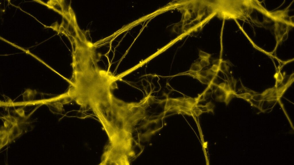 Fluorescence microscopy image of neuronal cells and branching processes