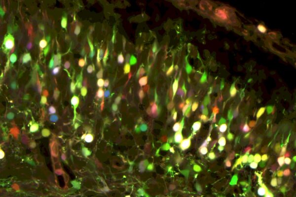 Brain Development & Disorders Symposium – November 11, 2026