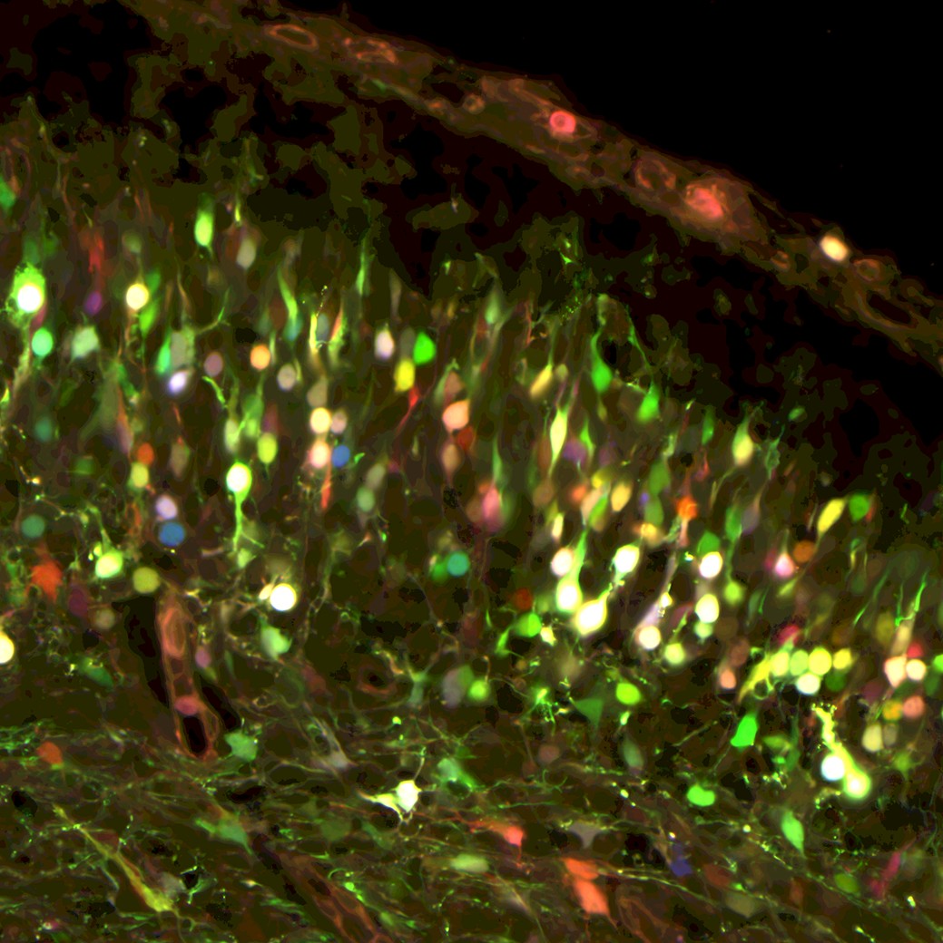 Fluorescence microscopy of brain tissue