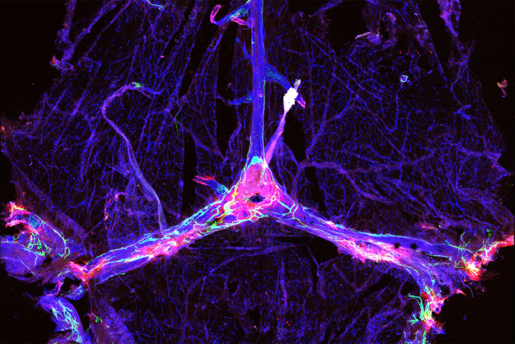 Microscopy image of blood vessels and drainage network in a mouse’s brain outlined in blue and green, and dotted with clumps of the Alzheimer’s protein amyloid beta in red