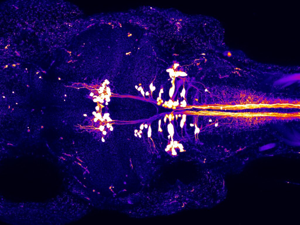 fluorescently labeled zebrafish nervous system