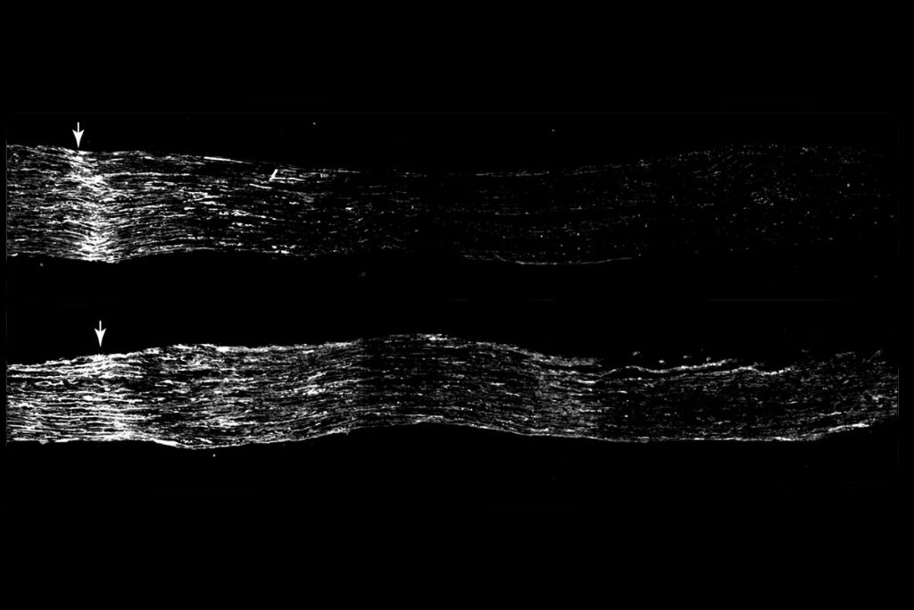 black and white microscopy image of mouse sensory neurons
