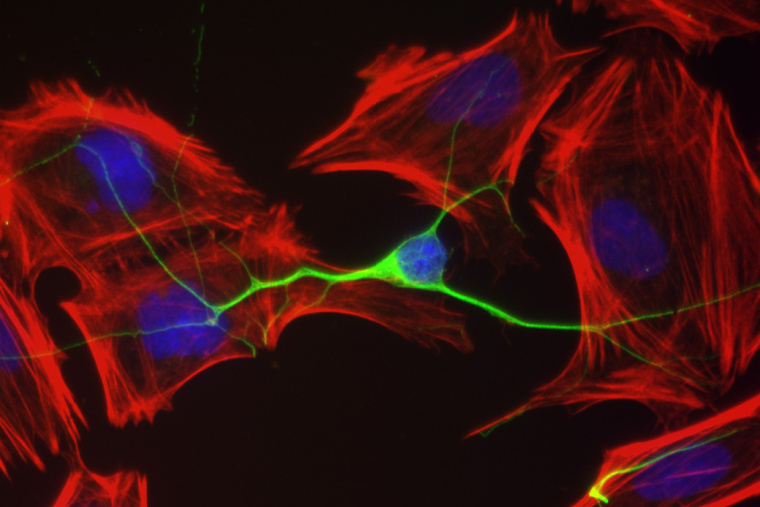 green fluorescent neuron surrounded by cells labeled red with blue nuclei