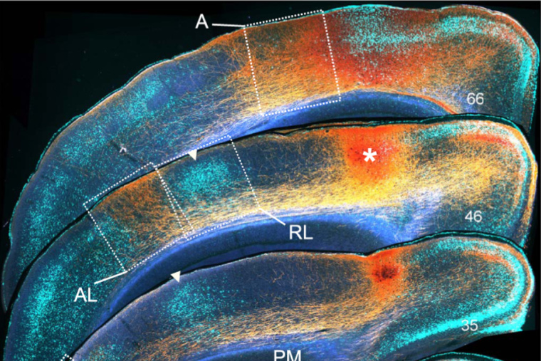 Rostrocaudal series of coronal sections of the left hemisphere of mouse brain in which the anteromedial area was injected with antergrade tracer BDA.