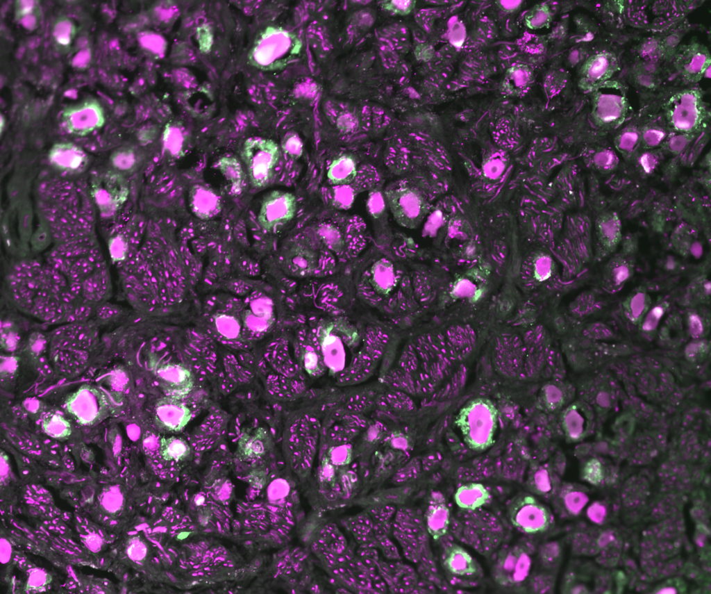 Human dorsal root ganglion stained for the neuronal marker TUJ1 (magenta) surrounded by satellite glial cells stained with FABP7 (green).
