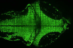 One plane through the zebrafish brain labeled with a fluorescent calcium indicator