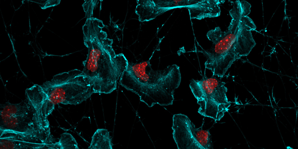 A mouse dorsal root ganglion immunostained for F-actin (phalloidin in cyan) and nuclei (DAPI in red). 