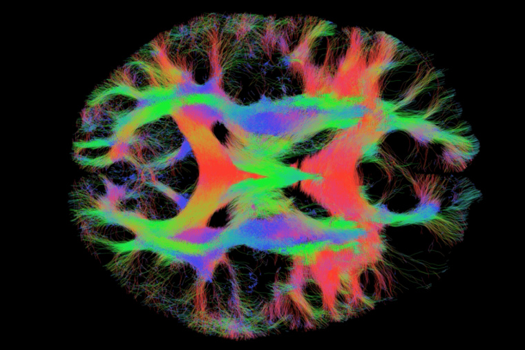 Brain tractography with connections colored red, green, blue and purple
