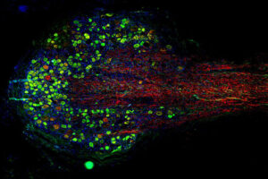 Pictured is a microscopic view of a human dorsal root ganglion. The nerve tissue is stained to reveal the cell bodies (in green) and axons (in red) of neurons that sense and transmit pain sensations.