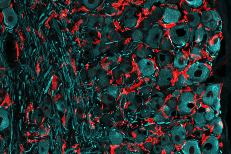 Dorsal root ganglion stained with TUJ1 (neuron, cyan) and IBA1 (macrophages, red)