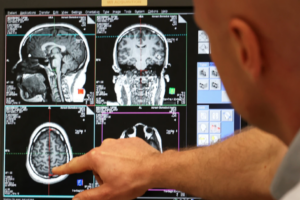 A man points at brain scans on a computer screen
