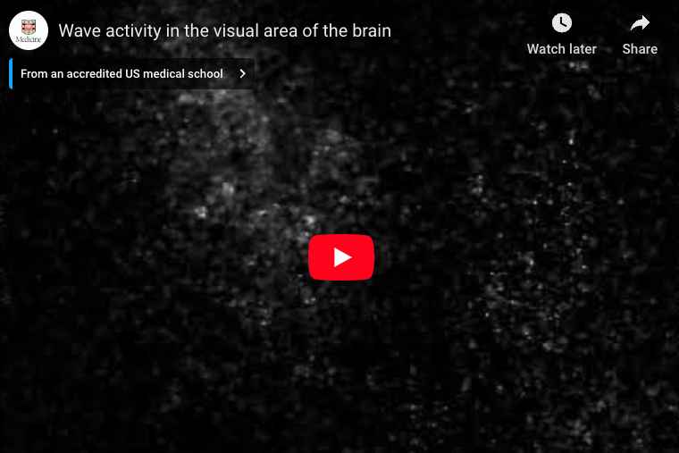 Video of a wave of electrical activity passes over the visual area of the brain of a marsupial joey.