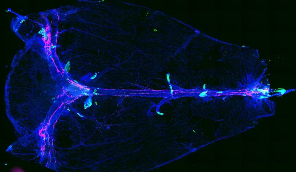 Researchers at Washington University School of Medicine in St. Louis have discovered an anatomical brain structure (in green) that allows fluid waste to leave the brain. In neuroinflammatory conditions in mice, immune cells use these routes to enter the brain.